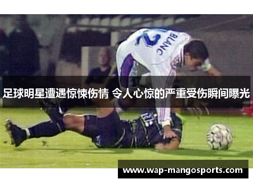 足球明星遭遇惊悚伤情 令人心惊的严重受伤瞬间曝光